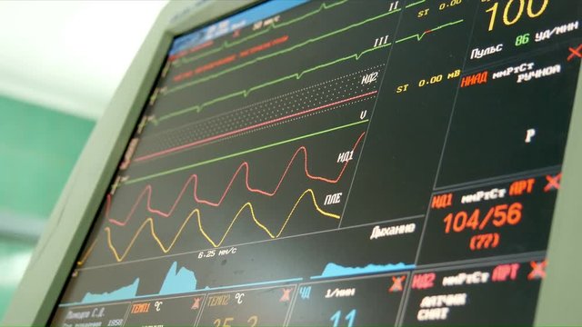 Medical monitor computer with indications of human heart activity