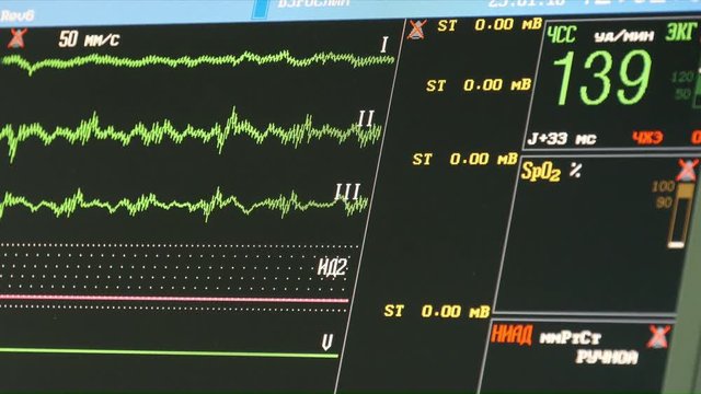 Monitor cardiac indications of human activities