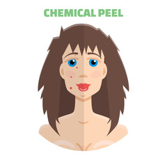 Cosmetic peeling. Chemical peeling before & after