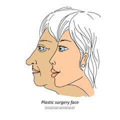 Plastic surgery face1