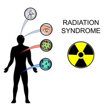 Radiation Syndrome