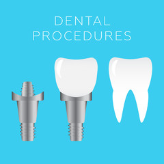 Stomatology and dental procedures