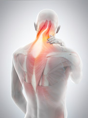 medically accurate 3d illustration of neck pain