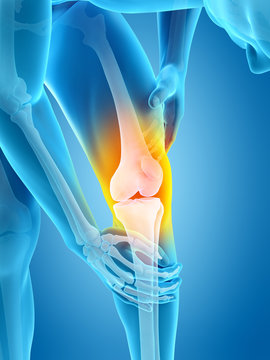 medically accurate 3d illustration of knee pain