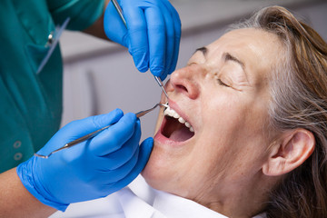 treatment of gingivitis at the dentist - obrazy, fototapety, plakaty