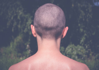 Bald girl