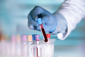 lab technician holding blood tube sample for study / hands of a lab technician with a tube of blood sample and a rack with other samples  - Powered by Adobe