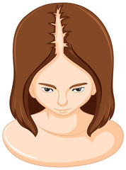 Hair loss in woman