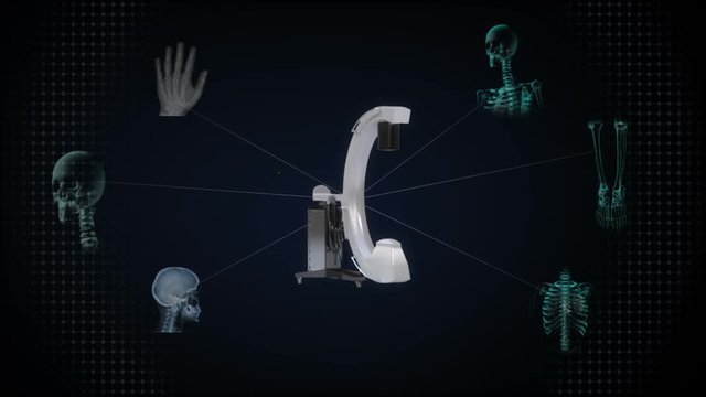C Arm X-Ray Machine Scanner, medical diagnosis technology. version 2.