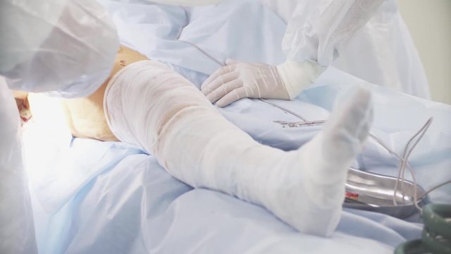 the patient's leg during hip surgery in the hospital. doctors operate on a patient. transplantation of joint.