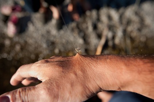 Fish hook pulling skin