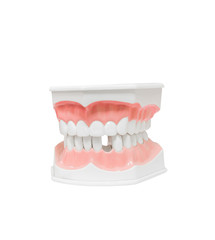 Dental Model of Teeth , and broken tooth , Isolated on white background clipping path