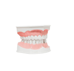 Dental Model of Teeth , and broken tooth , Isolated on white background clipping path