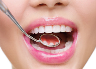 Healthy white woman's teeth and a dentist mouth mirror closeup
