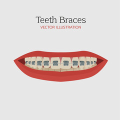 Teeth braces vector
