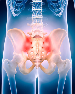 medically accurate 3d illustration of the painful hip