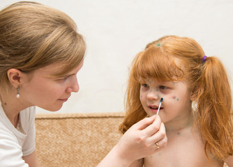 Маленькую девочку мама смазывает лекарством от...