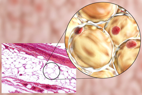 White adipose tissue, light micrograph and 3D illustration, hematoxilin and eosin staining, magnification 100x. Fat cells (adipocytes) have large lipid droplet which remains unstained