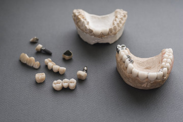 Dental prosthesis practice materials close-up. Top view on material for practicing dental implanting. Example sample and layout for prosthesis work.