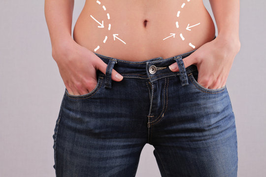 Woman weight loss, liposuction concept. Woman body with belly fat and correction Lines / Arrows