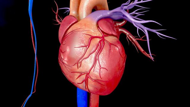 Myocardial infarction