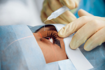 The operation on the eye
