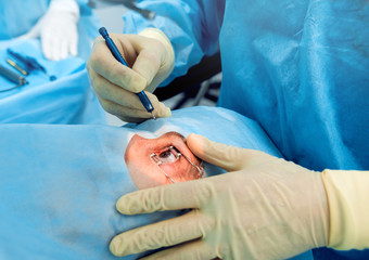 The operation on the eye