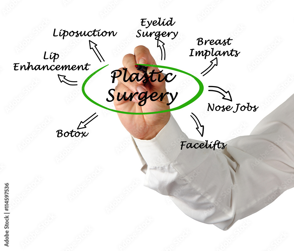 Canvas Prints Diagram of Plastic Surgery