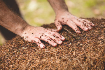 Ants biting man hands.