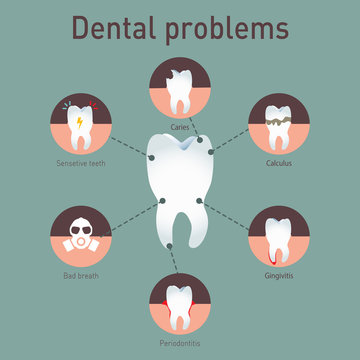 Medical vector infografics Dental problems.