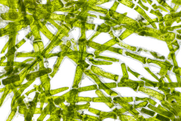Microscopic view of green algae (Cladophora) cells