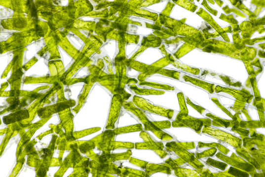 Microscopic View Of Green Algae (Cladophora) Cells