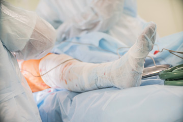 closeup of a foot with the bandage of the patient to surgery in the operating room in a hospital