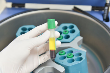 technician placing blood tubes in the laboratory centrifuge