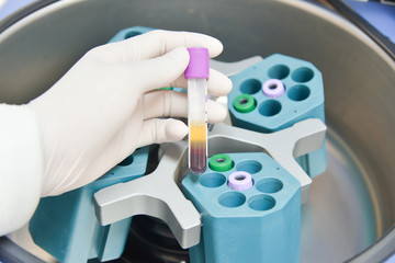 technician placing blood tubes in the laboratory centrifuge