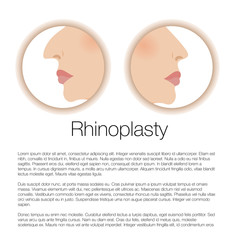illustration of rhinoplasty. cosmetic surgery. aesthetic medicine. vector