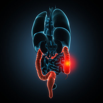intestines disease illustration