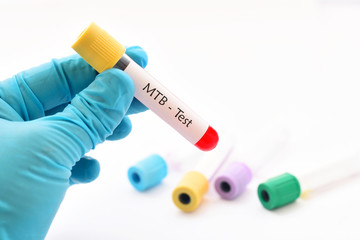 Blood sample for Mycobacterium tuberculosis (MTB) test
