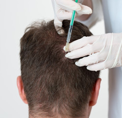 Handsome man is getting injection in head. Concept of Mesotherapy.