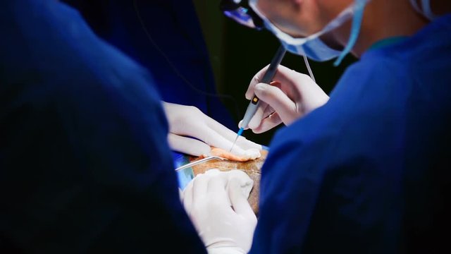 Two Surgeons Operate On A Patient .The operation of Craniotomy in the Hospital