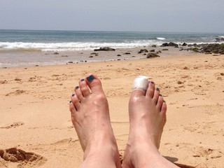 Füße mit verletztem Zeh am Strand/Meer