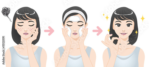 U0026quot Acne Treatment Before After Facial Cleansing Foam Cartoon Illustration U0026quot Stock Image And