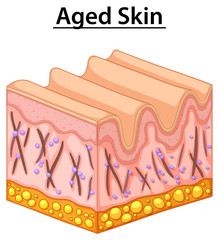 Close up diagram of aged skin