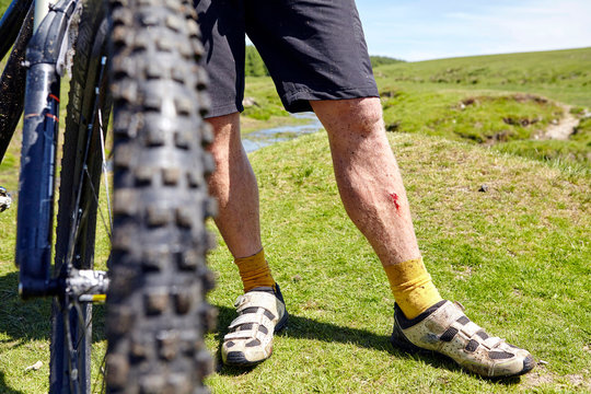 Cropped view of cyclists bleeding legs by bicycle