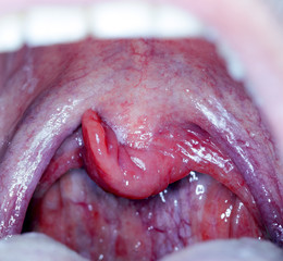 Naklejka premium throat tonsil