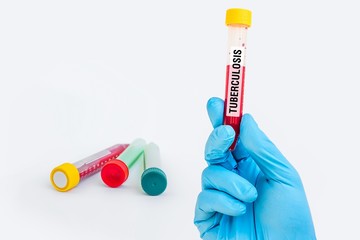 Test-tube with blood sample for TUBERCULOSIS test