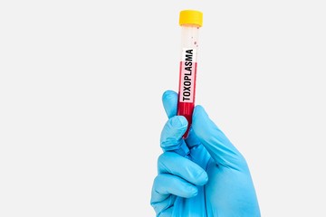 Test-tube with blood sample for TOXOPLASMA test