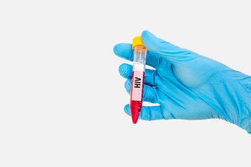 Test-tube with blood sample for HIV or AIDS test