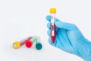 Test-tube with blood sample for H5N1 test