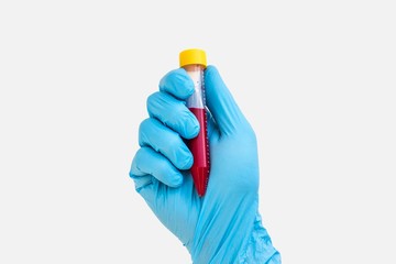 Test-tube in hand with blood